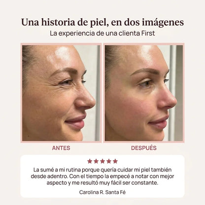 First® SKIN RENEW