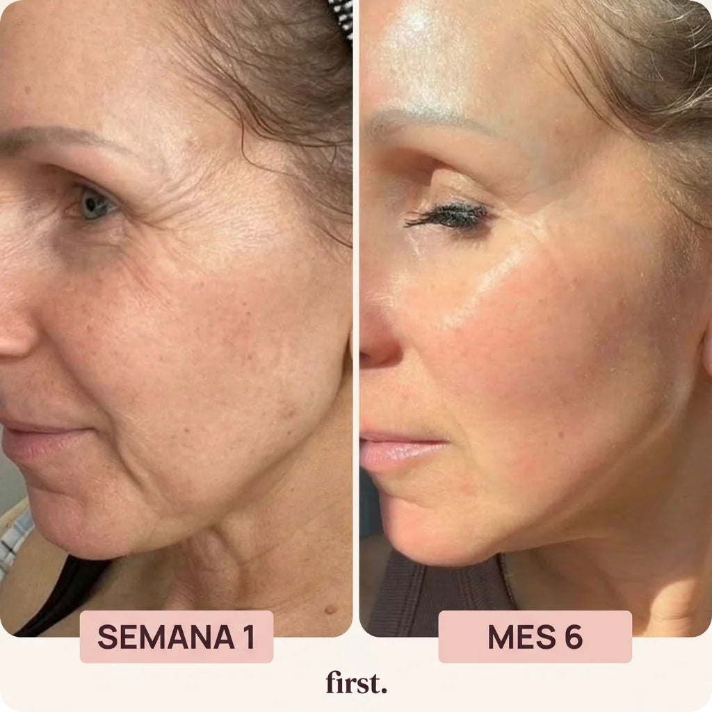 First® SKIN RENEW