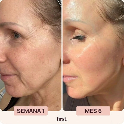 First® SKIN RENEW
